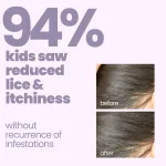 Tuco® Kids Natural Lice B - view 3