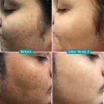 Pilgrim 10% Vitamin C Face - view 6