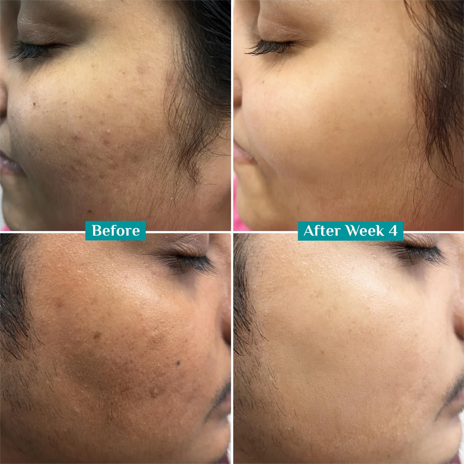 Pilgrim 10% Vitamin C Face - view 6