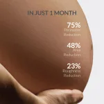 AreoVeda Stretch Marks Remov - view 2