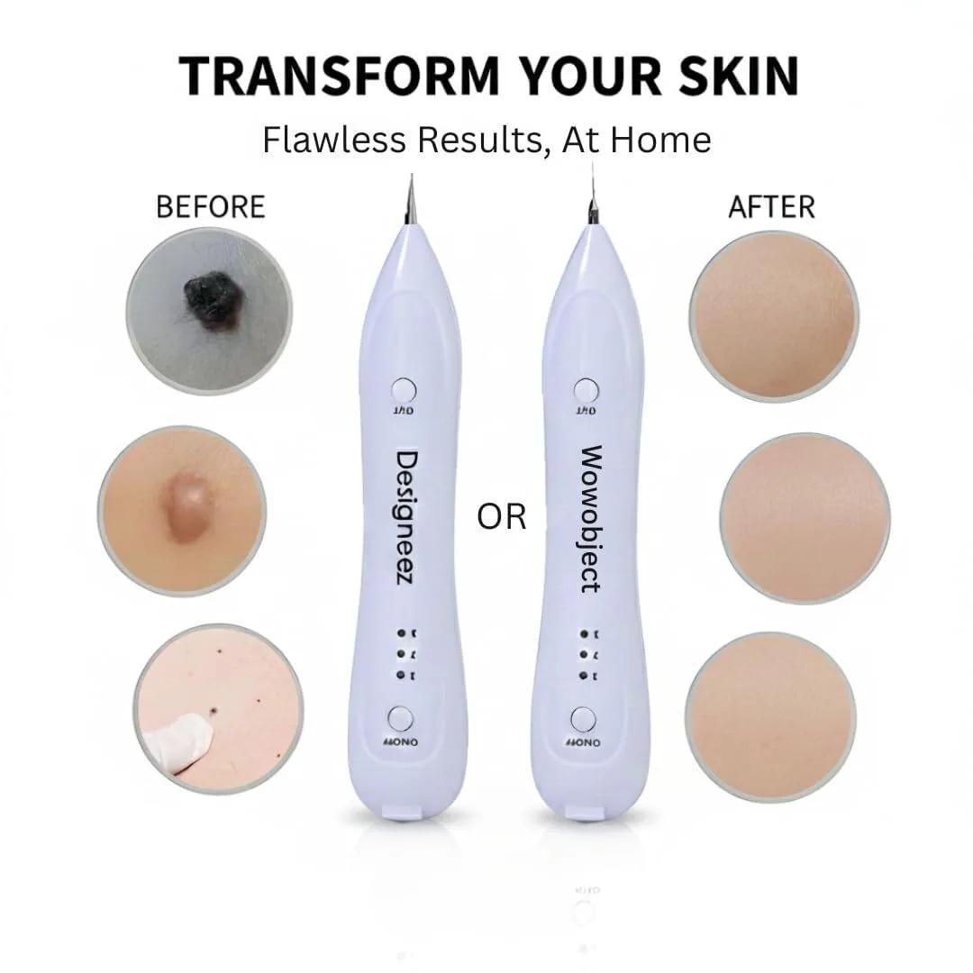 In-Depth Review: best skin tag remover - Electric Freckle Skin Mole Dark Spot Remover Pen Skin Tag Remover Dark Spot Wart Speckle Tattoo Removal Pen M 3 best skin tag remover view 1