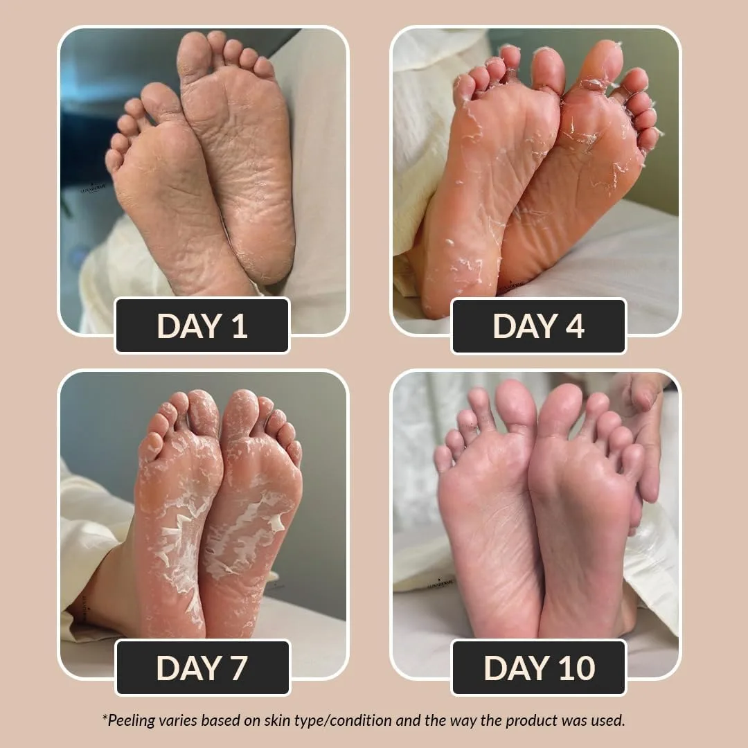 LuxaDerme Korean Foot Peeling - view 3