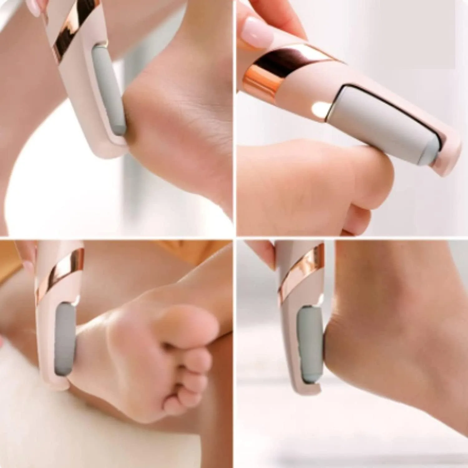 In-Depth Review: best callus remover tool - callus remover for feet dead skin remover pedicure tools Callus Remover Hard and Dead Skin Remover Electri 5 callus remover for feet de - view 4