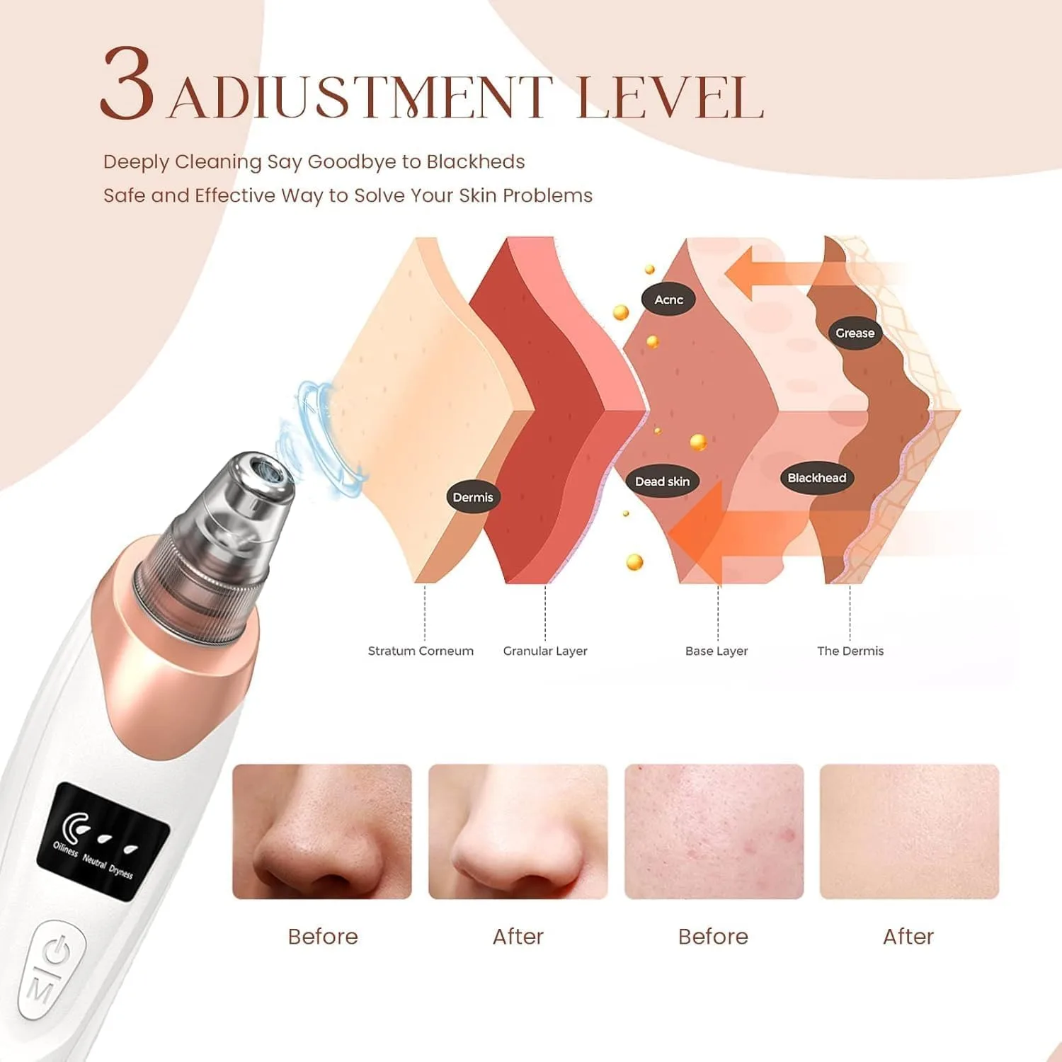 best pore cleaner vacuum view 6