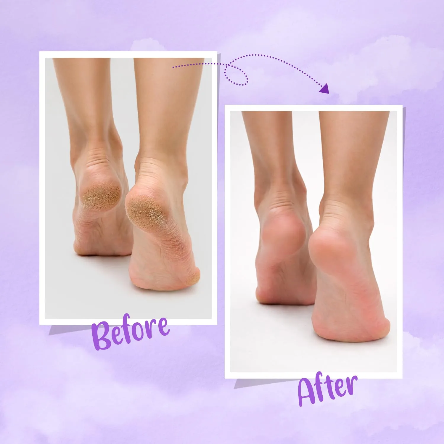 FURR Foot Pedicure Kit | - view 4