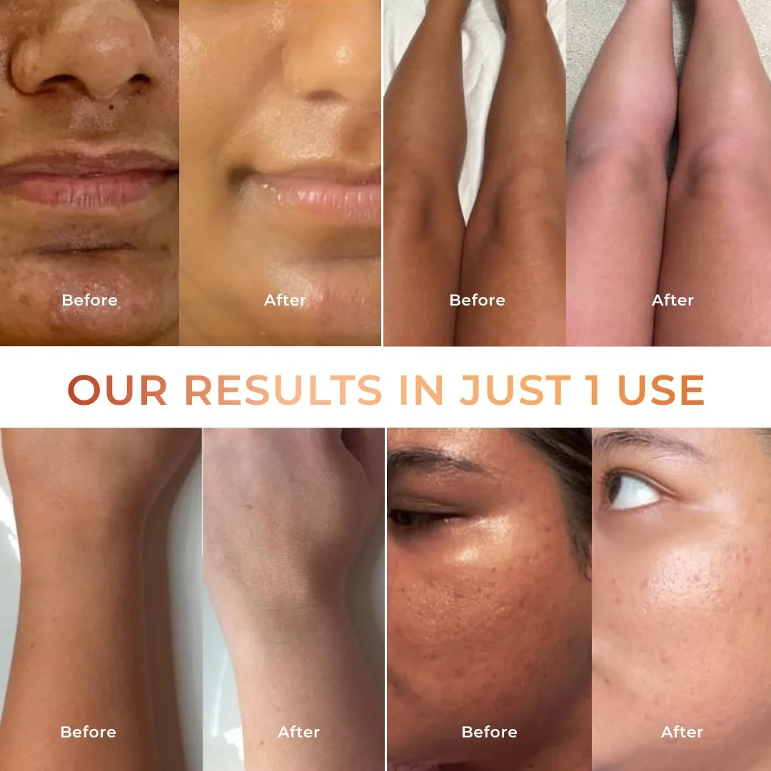 NICONI Tan Vanish Gluta-Ko - view 5