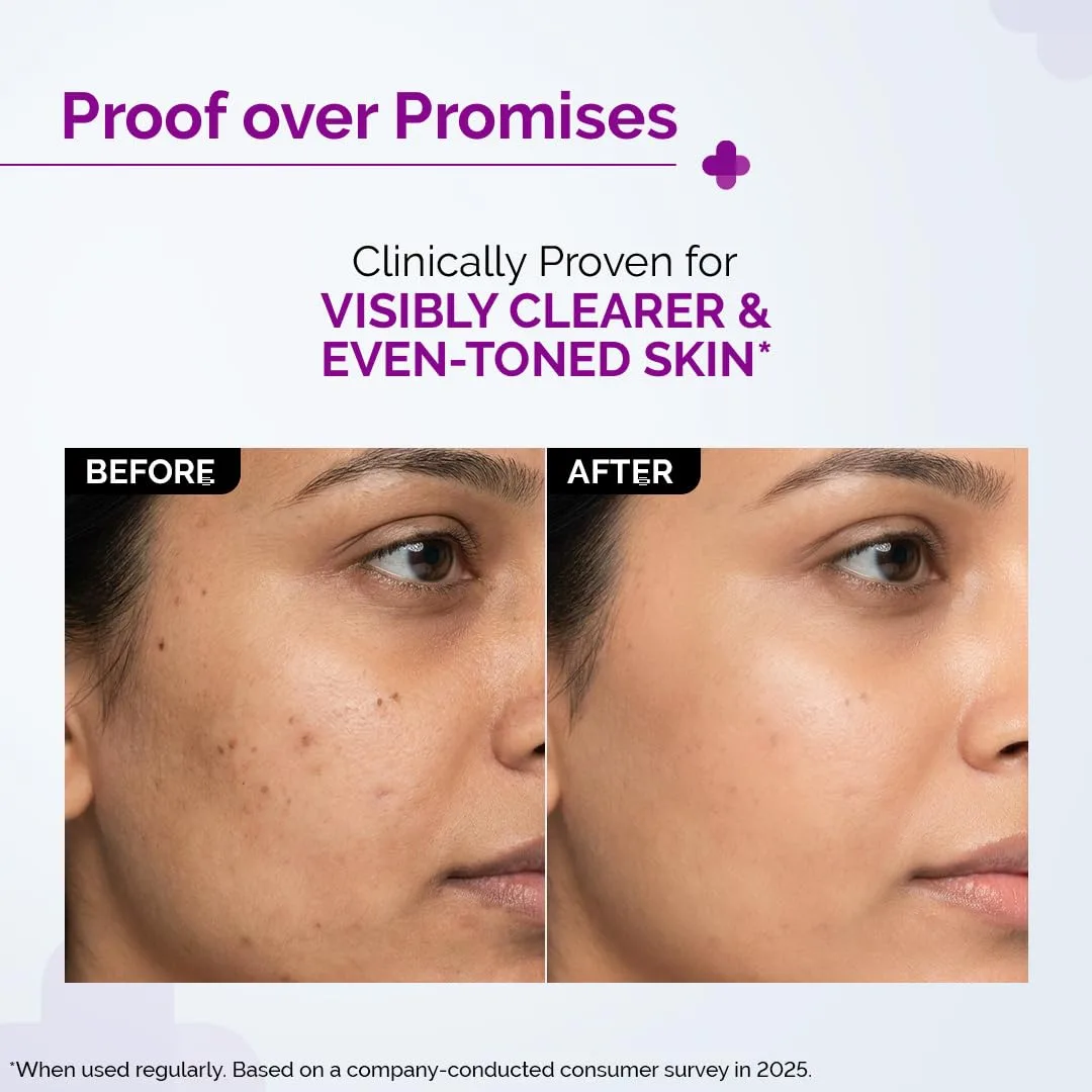 In-Depth Review: best organic skincare products india - best organic skincare products india – The Derma Co 10% Niac 5 The Derma Co 10% Niacin - view 4