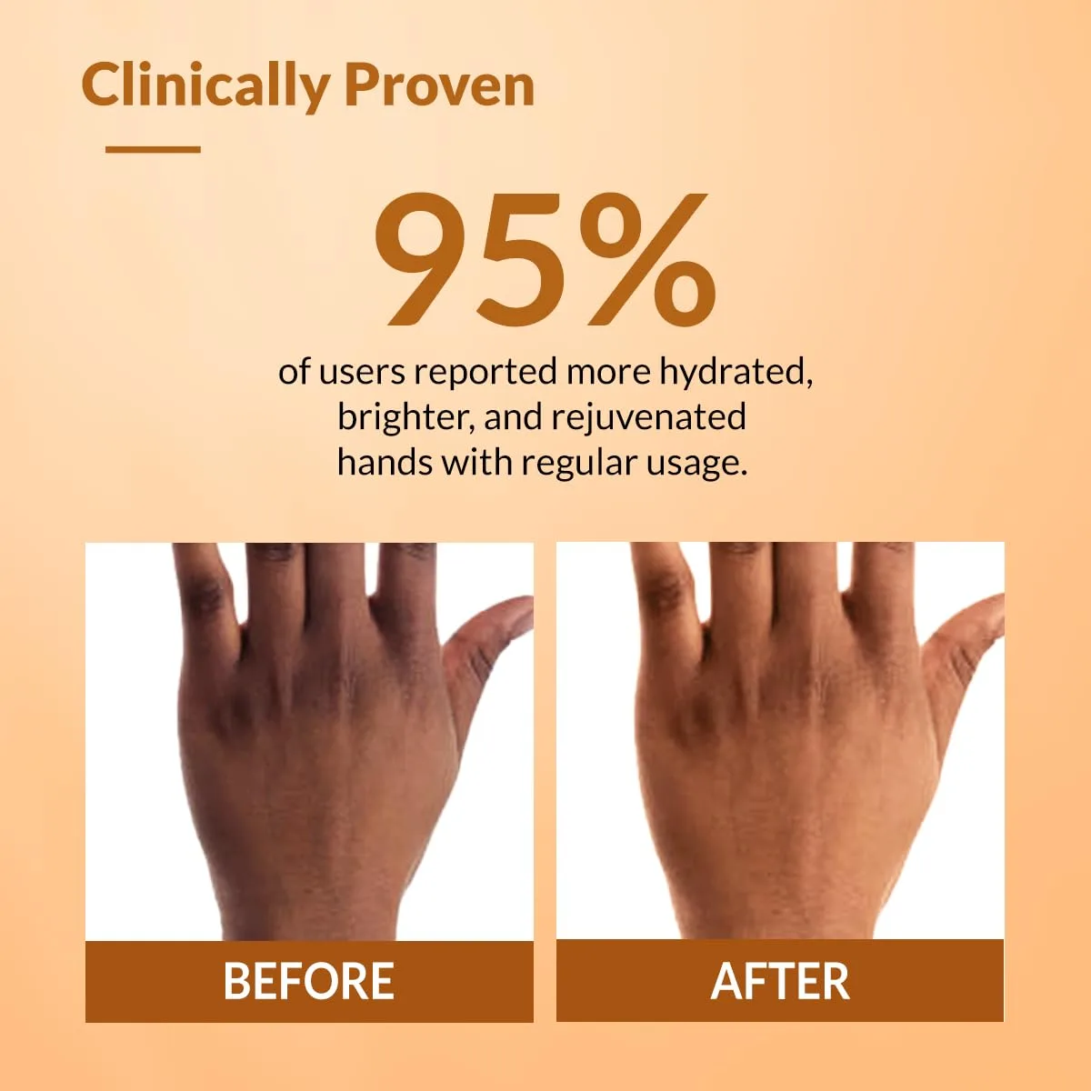best hand cream winter - Fixderma Hand Cream for Women & 6 Fixderma Hand Cream for Wome - view 6