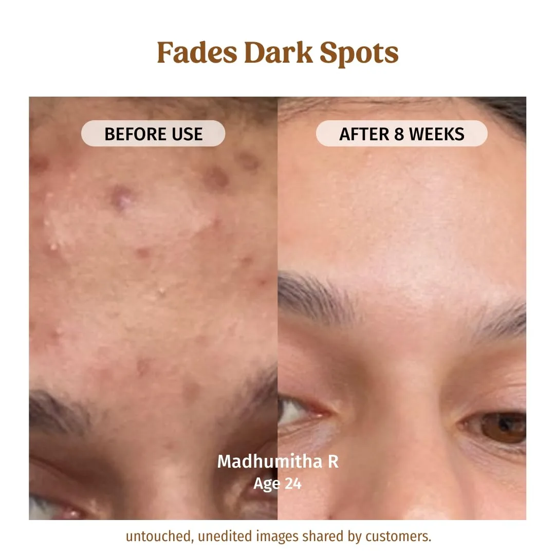 best clean beauty products india view 3