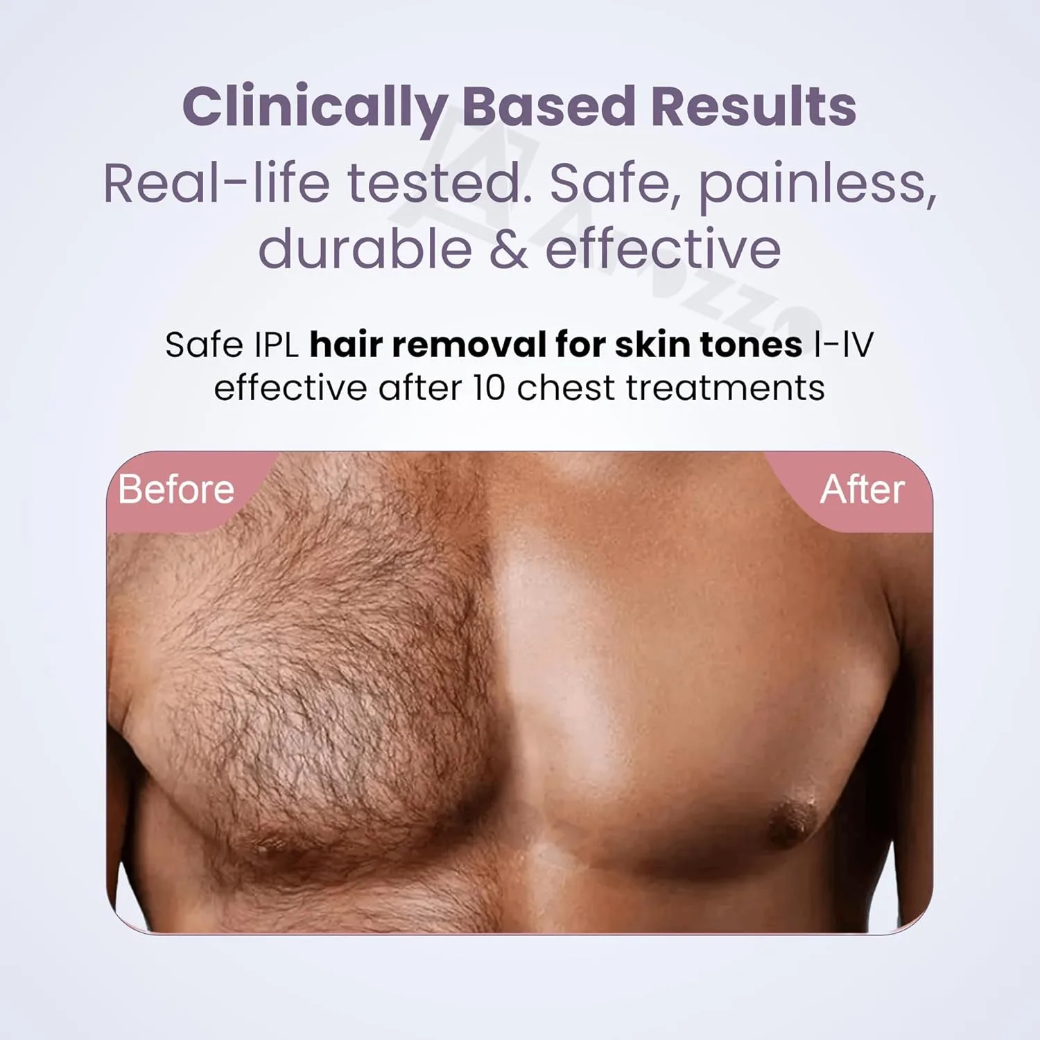 In-Depth Review: best ipl hair removal - IPL Hair Removal Handset for Women & Men – Painless Laser Machine for Permanent Hair Reduction on Face 8 IPL Hair Removal Handse - view 7