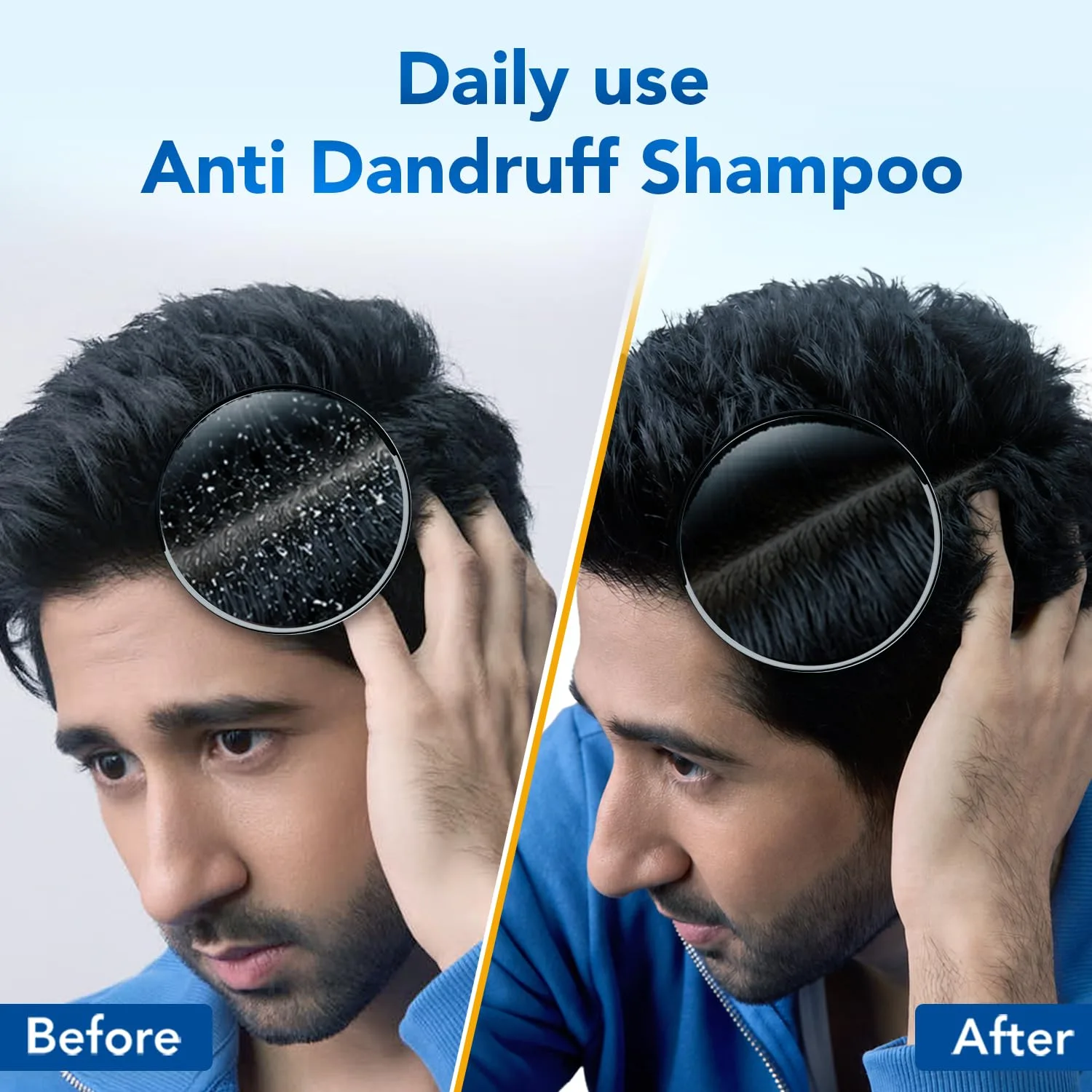 In-Depth Review: best anti dandruff shampoo - Scalpe Pro Daily Anti-Dandruff Shampoo | Removes Dandruff from Source | Prevents Itching & Irritati 4 Scalpe Pro Daily Anti-Dand - view 3