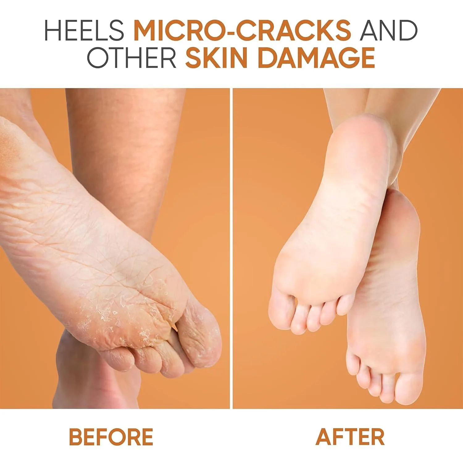In-Depth Review: best heel balm cream - Kliffoo Foot Repair Cream for Rough, Dry and Cracked Heel Feet, 20% Urea Cracked Heel Repair Balm Stick 40g, H 5 Kliffoo Foot Repair Cream f - view 4