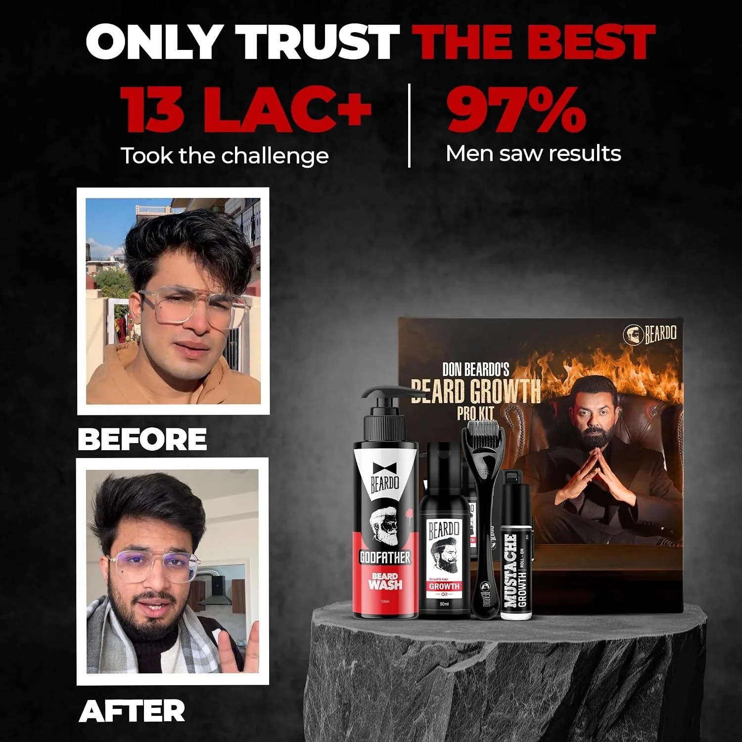 In-Depth Review: best beard grooming kit - BEARDO Don’s Beard Growth Pro Kit | Complete Beard Growth & Grooming Kit for Men | Ideal Gift for Me 4 BEARDO Don’s Beard Growt - view 3