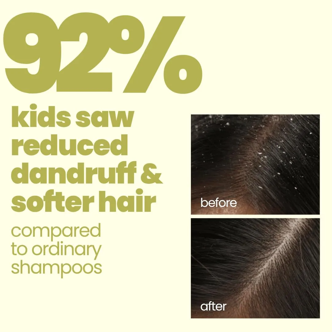 Tuco Kids Anti Dandruff - view 3