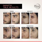 Deconstruct 5% Niacinamide Seru - view 4