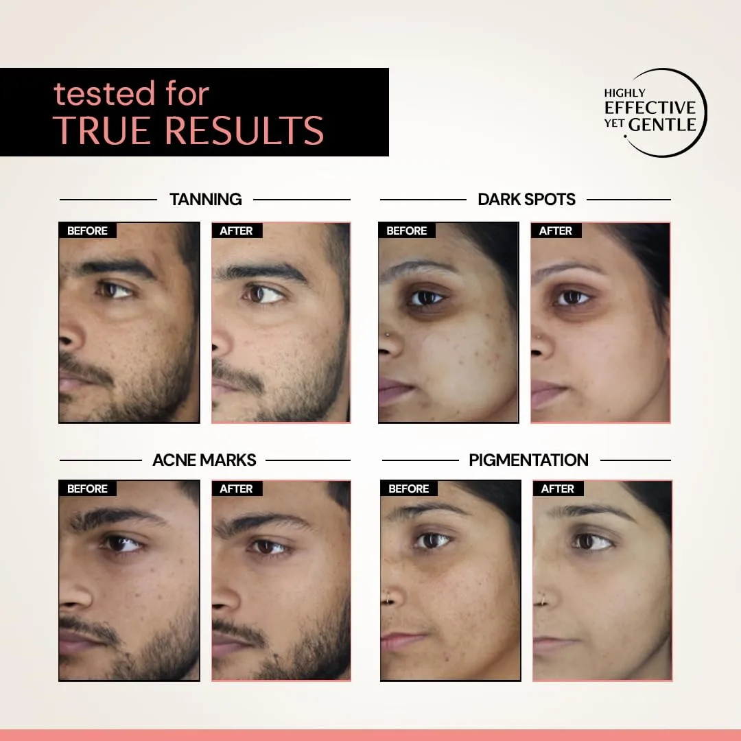 Deconstruct 5% Niacinamide Seru - view 4
