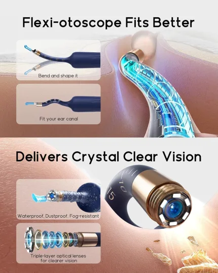 SELLASTIC Ear Cleaner Tool Ki - view 2