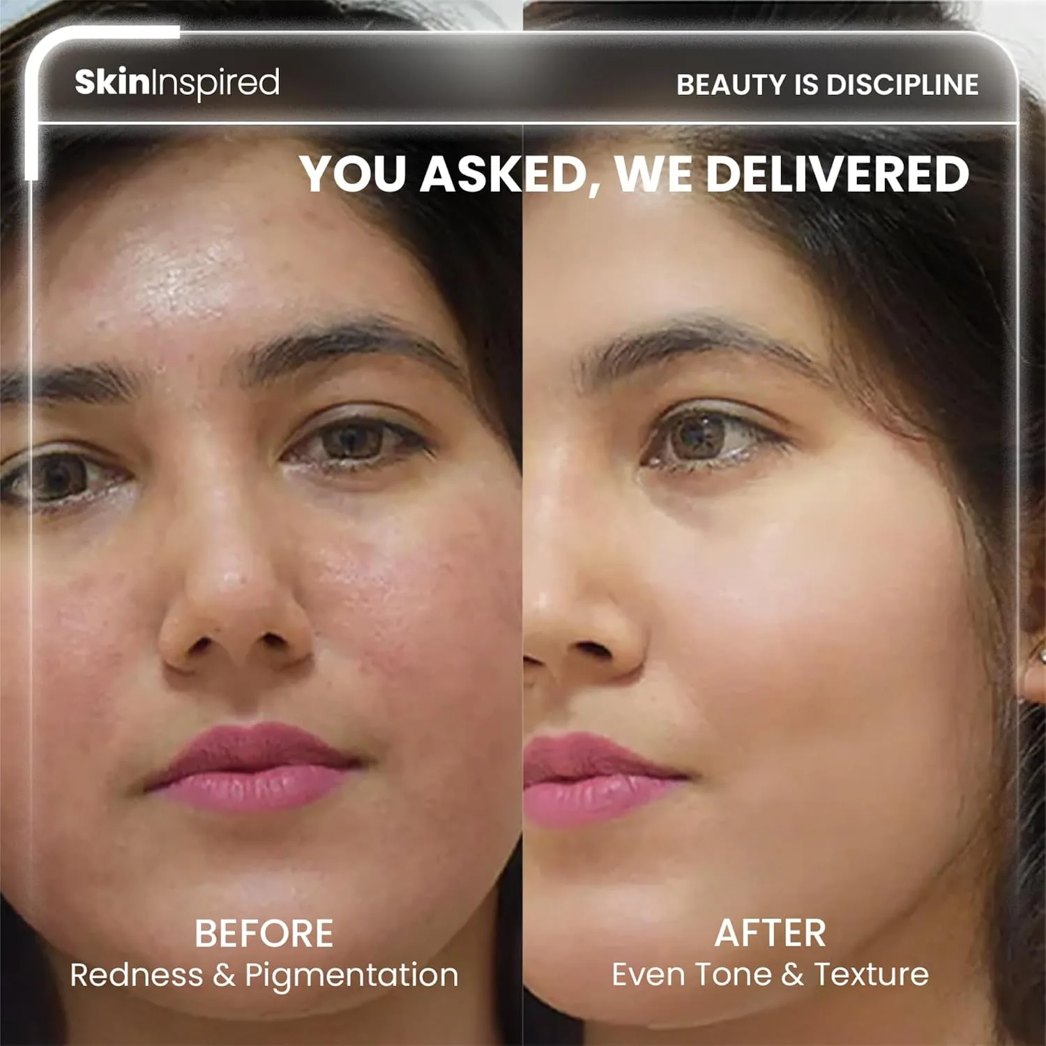 In-Depth Review: best anti aging cream - SkinInspired Retinol Night Cream For Wrinkles & Anti-Aging | 0.1% Retinol Which Is Encapsulated | Lightw 6 SkinInspired Retinol Night Cream - view 5