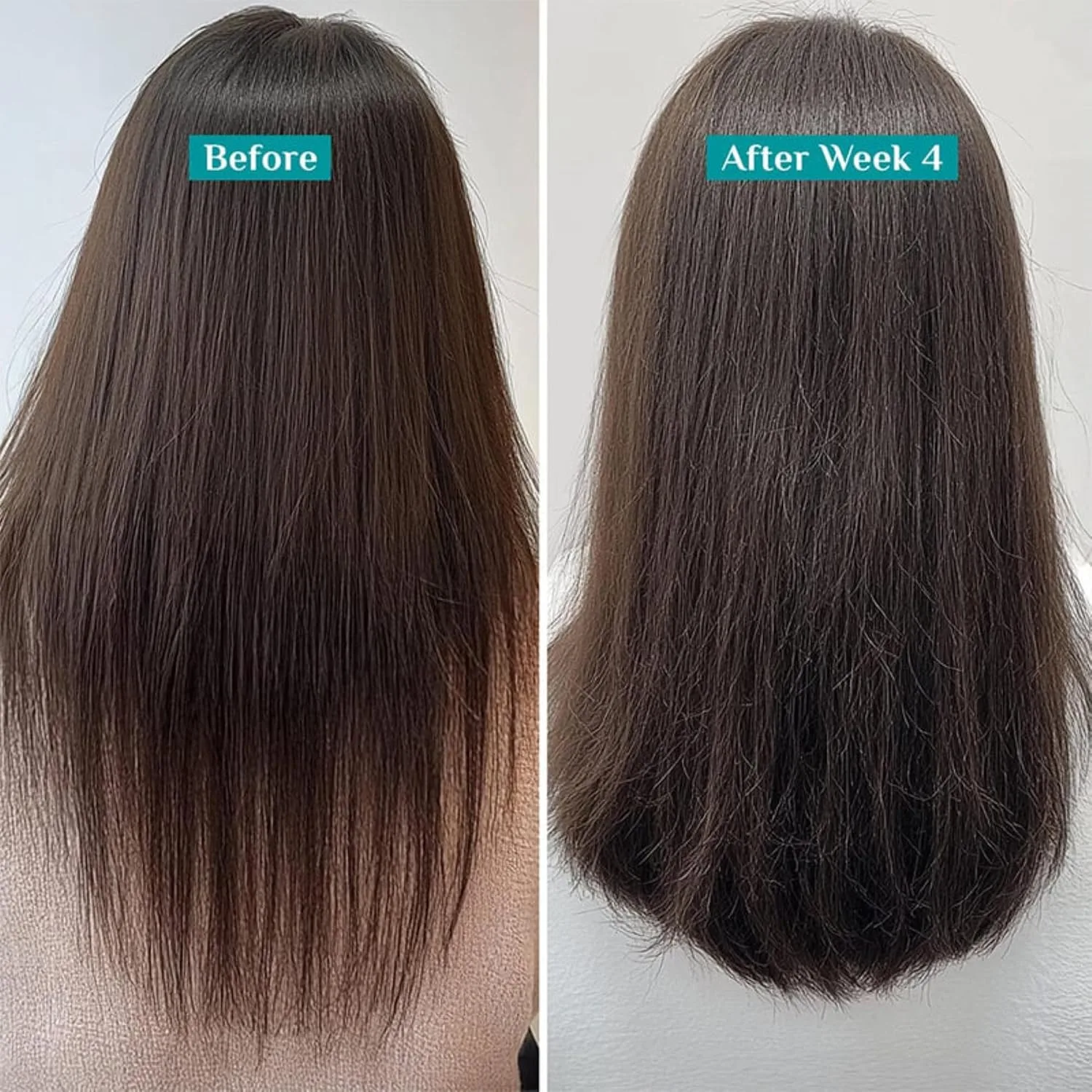 best hair growth serum - Pilgrim Redensyl & Anagain Hairfall 5 Pilgrim Redensyl & Anagain - view 5