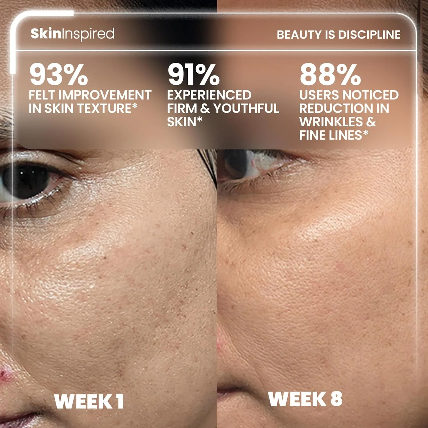 In-Depth Review: best anti aging cream - SkinInspired Retinol Night Cream For Wrinkles & Anti-Aging | 0.1% Retinol Which Is Encapsulated | Lightw 5 SkinInspired Retinol Night Cream - view 4